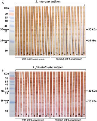 Reactivity of Horse Sera to Antigens Derived From Sarcocystis falcatula–Like and Sarcocystis neurona